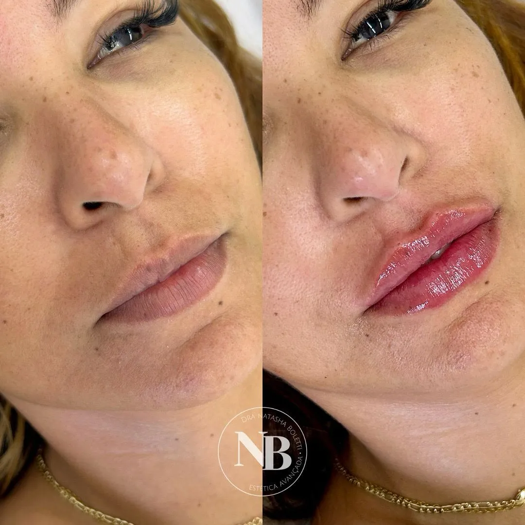antes-depois-nb 01